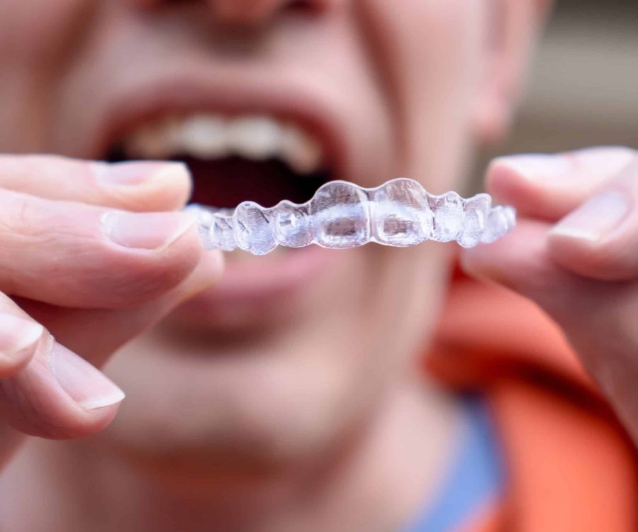 man-holds-put-on-invisible-braces-invisalign-plas-2022-11-15-14-04-36-utc